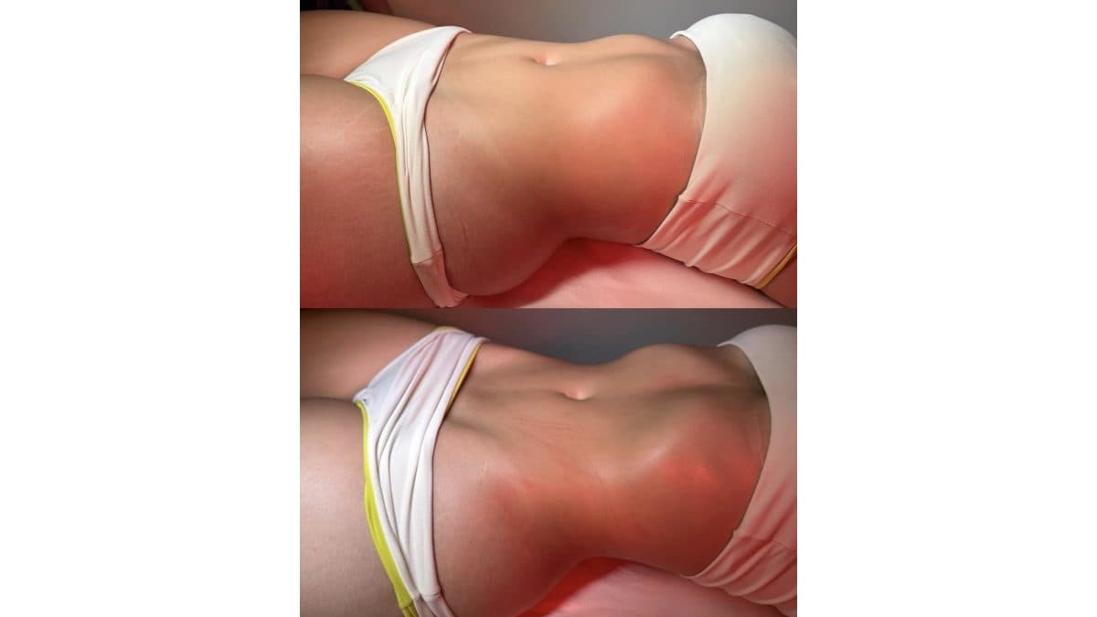 Rifa Especial – 4 Sessões de Massagem